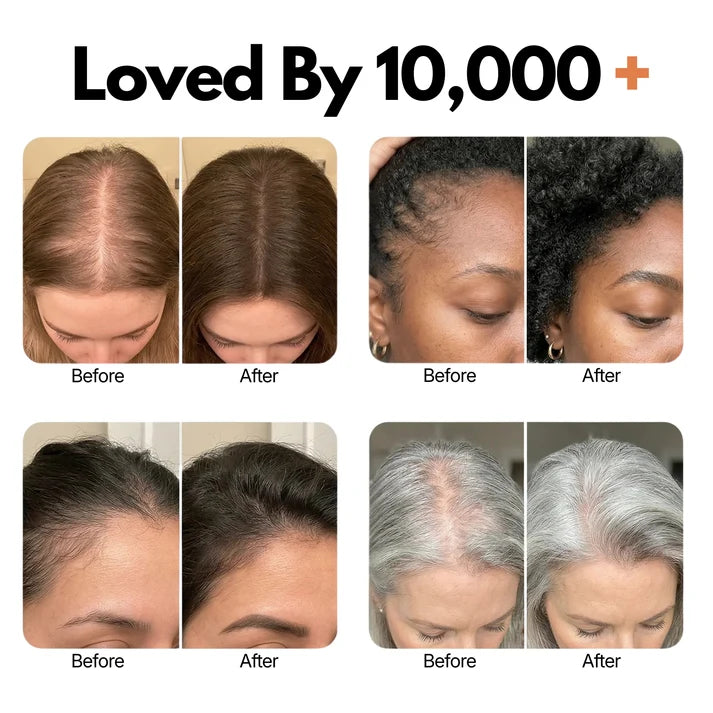 Korea's DNA #1 Hair Growth Serum