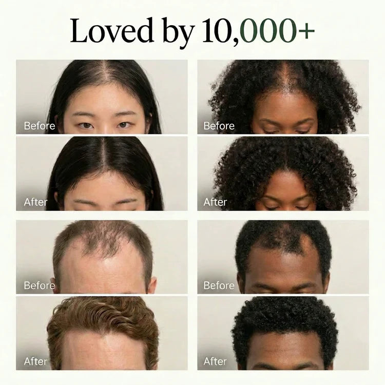 Korean Scalp Revival Bar