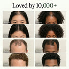 Korean Scalp Revival Bar