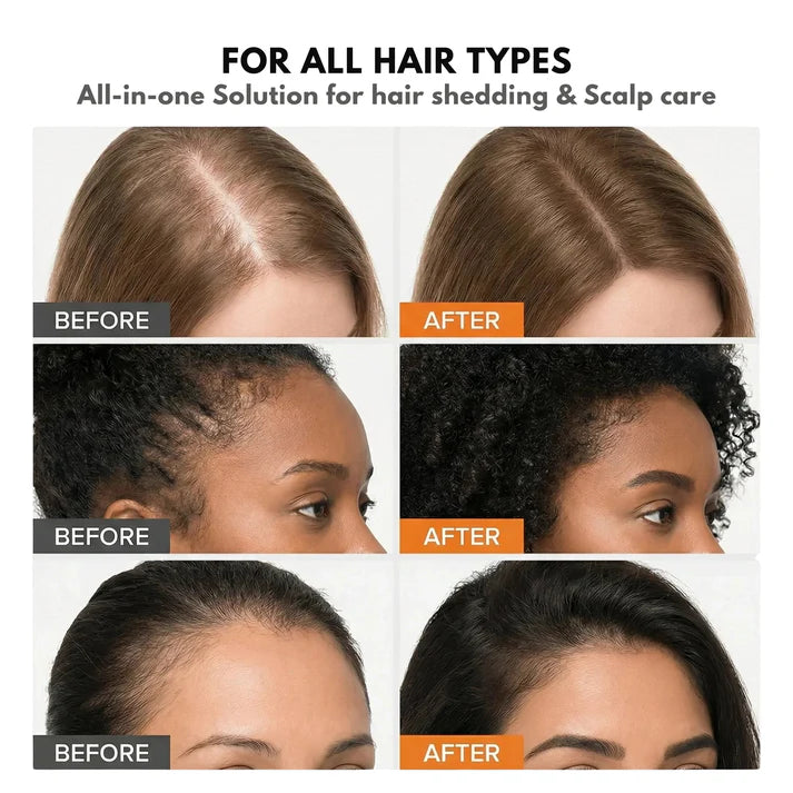 Korea's DNA #1 Hair Growth Serum
