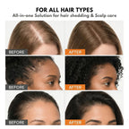 Korea's DNA #1 Hair Growth Serum